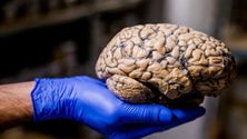Imagem de Desequilíbrio do pH no cérebro pode ser causa de Alzheimer