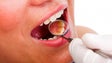 Madeira vai aderir Projeto de Intervenção Precoce do Cancro Oral