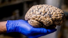Imagem de Coimbra estuda efeitos do stress no cérebro