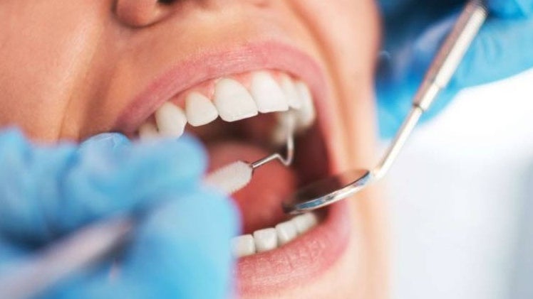 Quase 7% dos portugueses nunca vão ao dentista