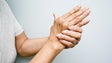 Muitos doentes com artrite reumatoide podem estar com medicação em excesso