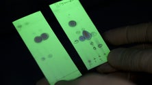 Imagem de Detetado pigmento que pode ajudar no diagnóstico do cancro colorretal