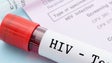 Relatório sobre o VIH em Portugal só será divulgado para o ano