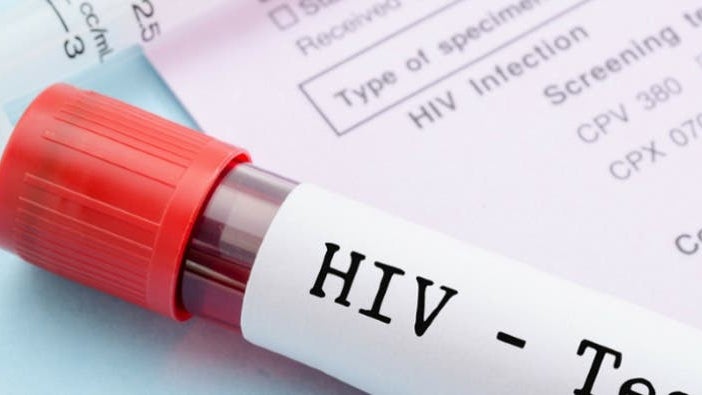 Relatório sobre o VIH em Portugal só será divulgado para o ano