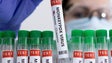 Imagem de Monkeypox: Regulador da UE recomenda vacina contra varíola para prevenção da doença