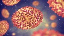 Imagem de Número de casos confirmados de Monkeypox subiu para 37 em Portugal