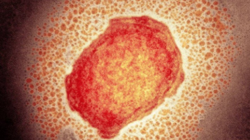 Imagem de Relacionar orientação sexual com vírus Monkeypox «não faz qualquer sentido»