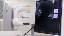 Imagem de Rastreio do cancro da mama em Santa Maria Maior e Porto Moniz