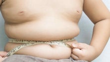 Imagem de Aumento da obesidade infantil nos últimos três anos preocupa nutricionistas