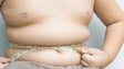 Imagem de Aumento da obesidade infantil nos últimos três anos preocupa nutricionistas