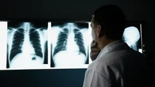 Imagem de Campanha alerta para importância de diagnóstico precoce na fibrose pulmonar