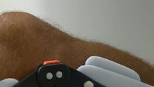 Imagem de “Knee Summit” trouxe ao Funchal vários especialistas em lesões do joelho (Vídeo)