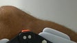 Imagem de “Knee Summit” trouxe ao Funchal vários especialistas em lesões do joelho (Vídeo)