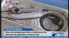 Há um novo tratamento para a pedra no rim (Vídeo)