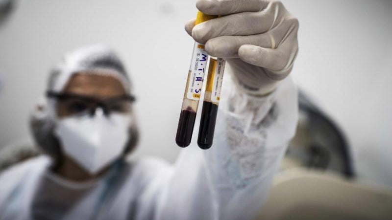 Imagem de Covid-19: Mais de 731 mil mortos e 19,8 milhões de infetados em todo o mundo