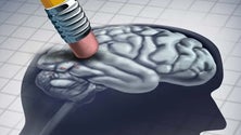 Imagem de Alzheimer atinge precocemente diferentes regiões cerebrais