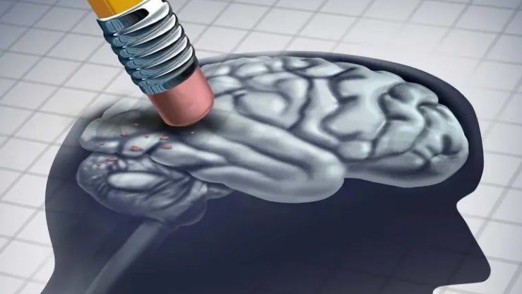 Imagem de Alzheimer atinge precocemente diferentes regiões cerebrais