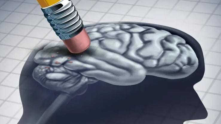 Alzheimer atinge precocemente diferentes regiões cerebrais