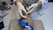 Imagem de Portugueses sabem o que é o colesterol mas desconhecem os seus próprios níveis