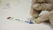 Imagem de Região está comprometida em erradicar a Hepatite C até 2030