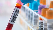 Imagem de Colheitas de sangue condicionadas pela falta de tubos