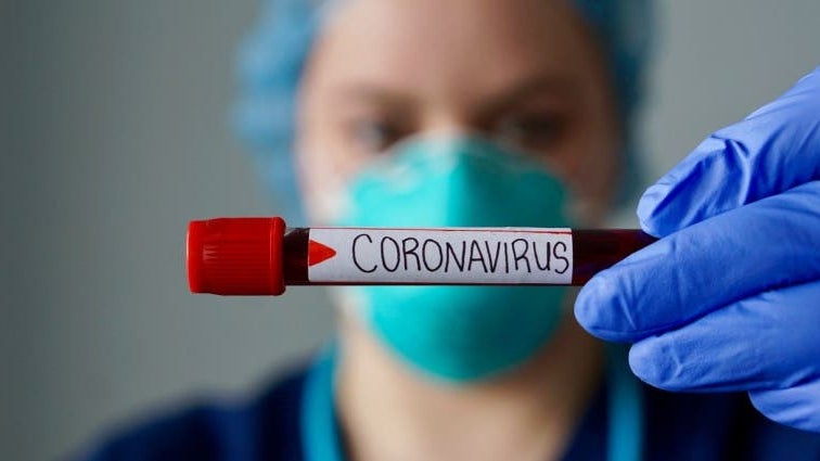 Imagem de Açores com 30 casos e 26 recuperações