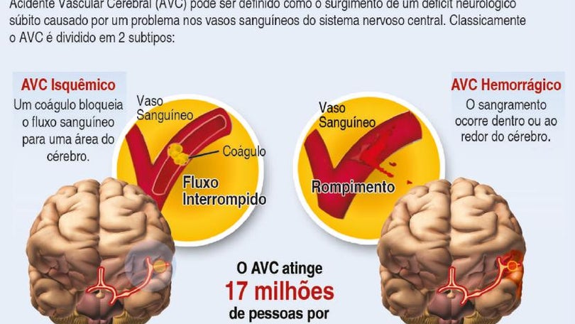 Por hora, três portugueses sofrem um AVC