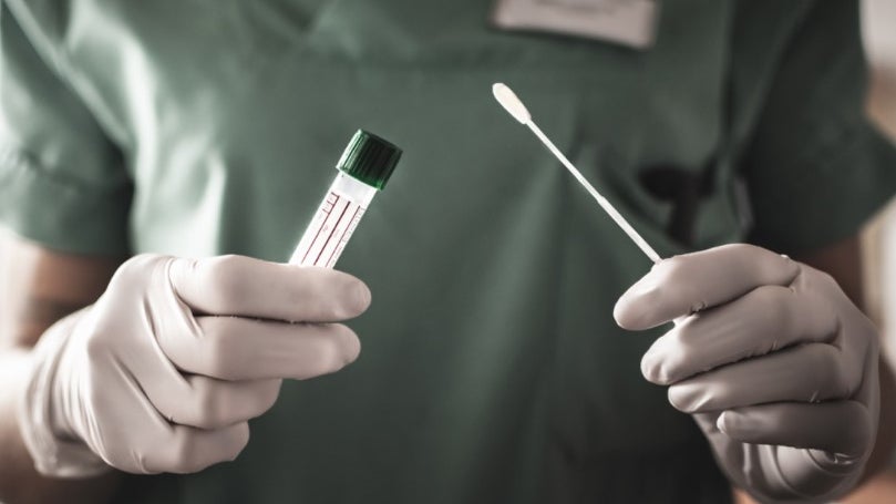 Imagem de Covid-19: Governo da Madeira reforça postos para testes de despiste no continente