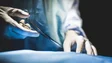 Sociedade da Transplantação alerta que falta de profissionais na saúde pode condicionar atividade
