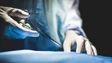 Imagem de Sociedade da Transplantação alerta que falta de profissionais na saúde pode condicionar atividade