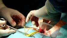 Imagem de Afeganistão: OMS avisa que só tem material médico para uma semana