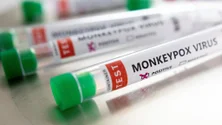 Imagem de Nova Iorque declara varíola dos macacos como emergência de saúde pública
