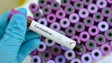 Imagem de Covid-19: Quase 300 mil mortos e mais de 4,3 milhões de infetados em todo o mundo