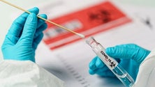 Imagem de Covid-19: Novos casos recuam para 279 e mortes para 43 na Bélgica