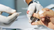 Imagem de Mais de 96% dos doentes em tratamento contra hepatite C curados