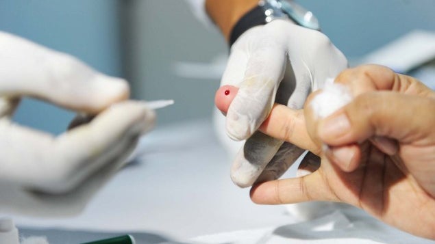 Imagem de Mais de 96% dos doentes em tratamento contra hepatite C curados