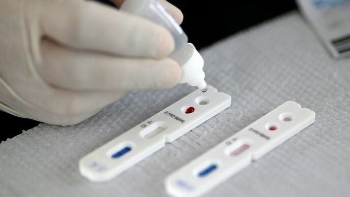 Imagem de SESARAM disponibiliza testes rápidos aos lares