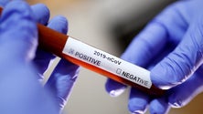Imagem de Segundo caso suspeito de coronavírus na Madeira