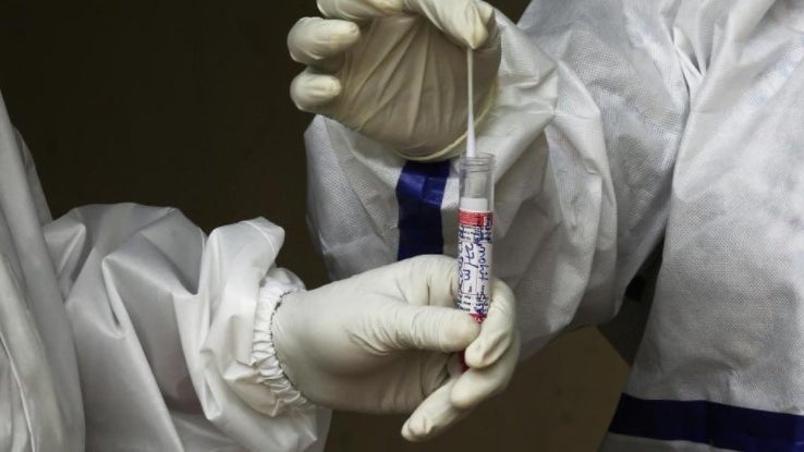 Imagem de Covid-19: Testes rápidos podem ter fiabilidade de 95% se forem moleculares, diz especialista