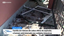 Imagem de Homem vítima de explosão internado nos cuidados intensivos com queimaduras graves (Vídeo)
