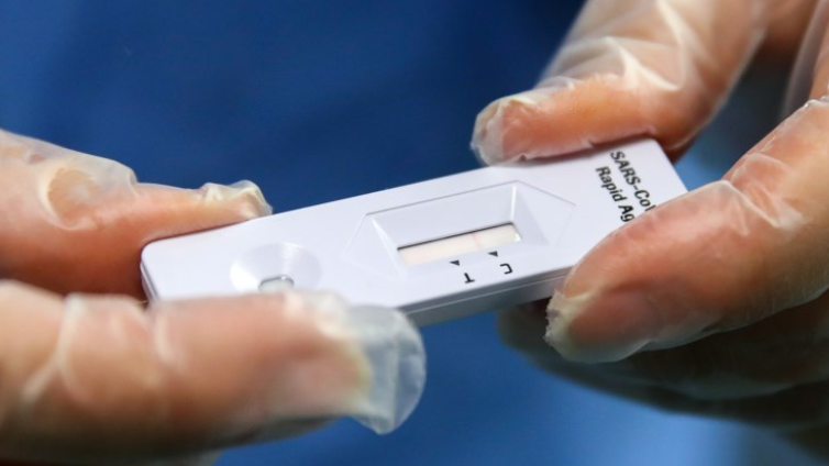 Imagem de Resultados de autotestes já podem ser comunicados na plataforma eletrónica