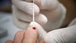 Portugal entre os países europeus mais bem sucedidos na luta contra o VIH