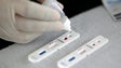 Imagem de Ordem dos Médicos quer testes rápidos aos cidadãos que estarão nas mesas de voto