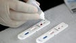 Ordem dos Médicos quer testes rápidos aos cidadãos que estarão nas mesas de voto