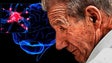 Imagem de Cerca de 500 madeirenses sofrem de Parkinson
