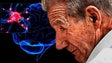Cerca de 500 madeirenses sofrem de Parkinson