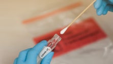Imagem de Covid-19: Doentes devem ser testados quatro semanas após primeiros sintomas – estudo