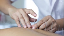 Imagem de OMS apoia medicina tradicional nos cuidados de saúde