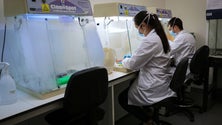 Imagem de Bactérias do intestino podem influenciar personalidade