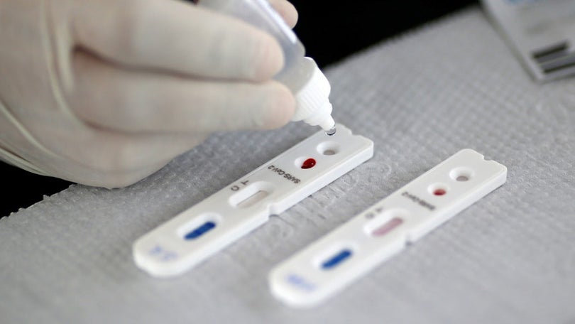 Testes rápidos vão pode ser adquiridos em farmácias
